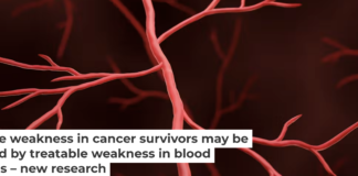 Poorly functioning blood vessels lead to the characteristic muscle weakness that so many cancer patients experience. Artur Plawgo/Science Photo Library via Getty Images